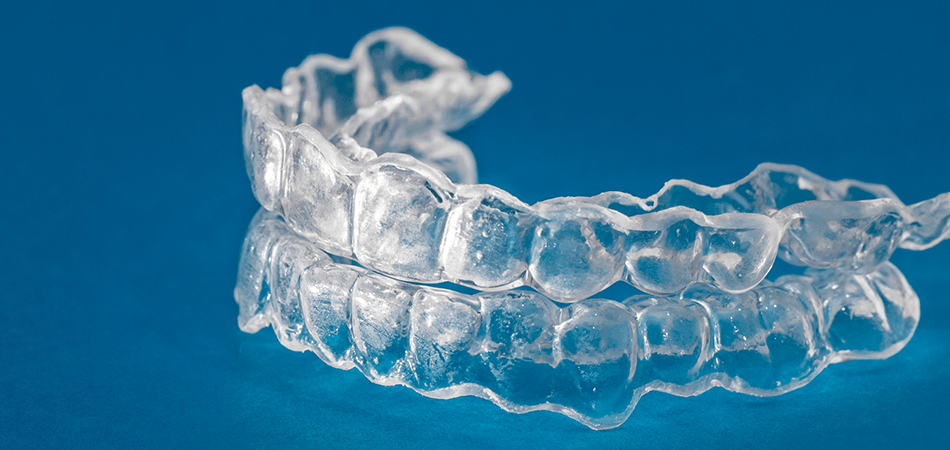 clear aligners