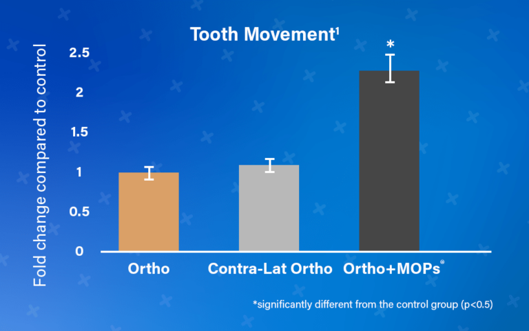 MOPs and Orthodontic Tooth Movement 3 Tooth Movement Chart