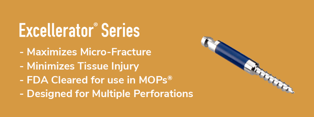 Excellerator Series Tips: the only option for MOPs 1 Excellerator Series